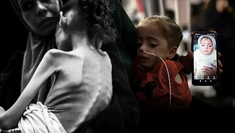 Küçük Meryem'in Düşük Kilolu Halleri Şaşırtıyor: Açlıkla Mücadele Süreci