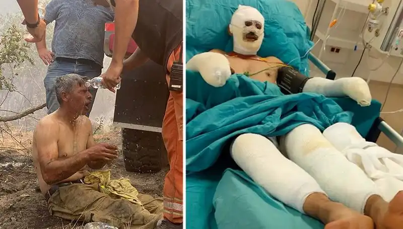 "Yanıyorum Diye Feryat Eden Orman İşçisinin Talihsiz Hikayesi"