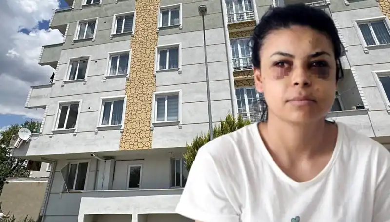 Düğün Magandası Korkuttu: Saçmalar Gözüne Isabet Etti!